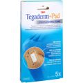 TEGADERM 3M Plus Pad 6x10 cm Fertigverb.3584NP